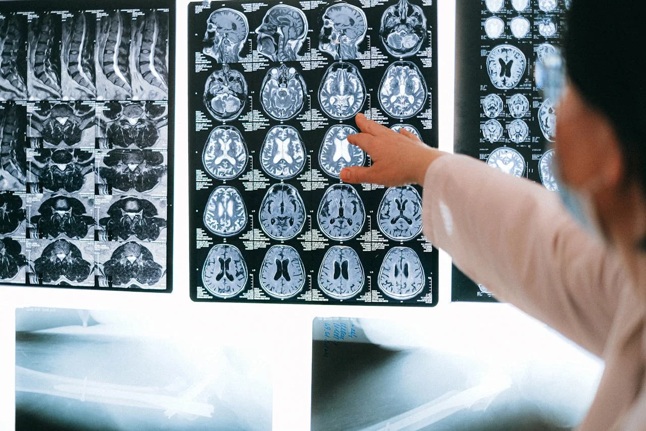 Neurologie